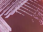 Another man has died with melioidosis in Queensland this week.