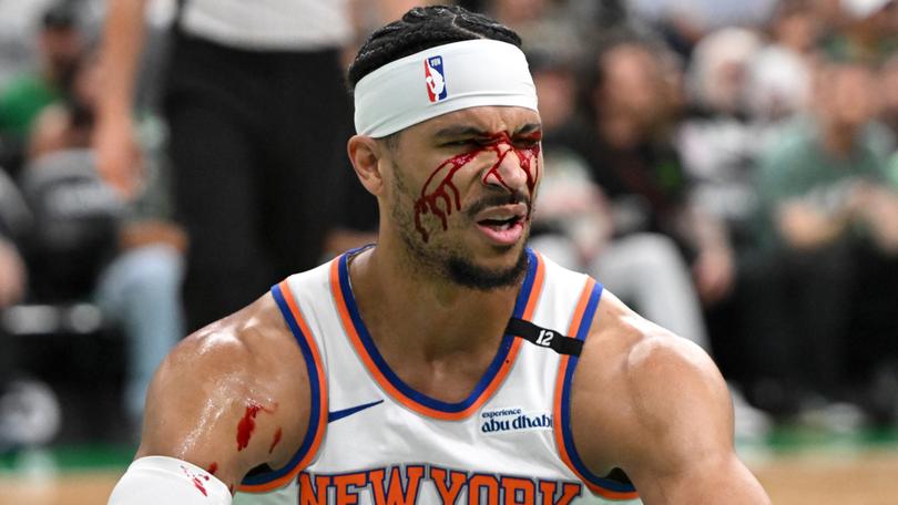 Josh Hart copped an elbow to the face during New York’s Game 5 loss to Boston.