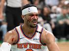 Josh Hart copped an elbow to the face during New York’s Game 5  loss to Boston.