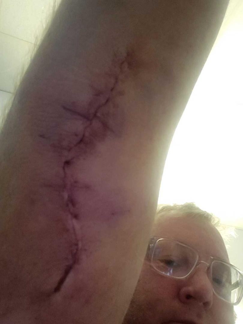 Toby Hoskin suffered serious arm injuries in a boat accident earlier this month.