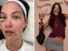 Perth influencer Jacquie Alexander has documented her first time getting a salmon sperm facial and hoped rejuvenating results made the painful experience worth it.