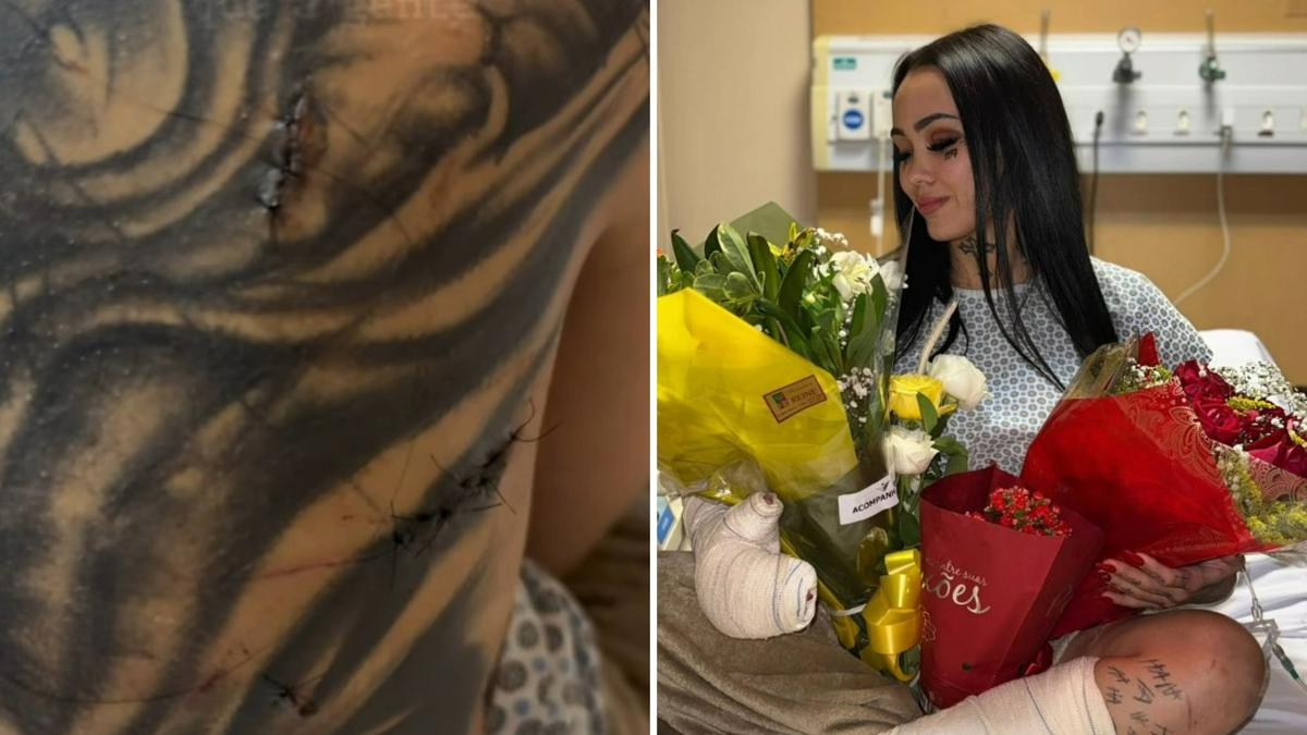 Beauty Influencer Survives Horrific Stabbing Attack