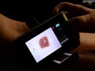 Skin cancers along with diseases linked to obesity are tipped to rise in the next two decades. 