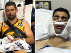 Whittlesea captain Xavier Dimasi is still recovering from his facial injury.