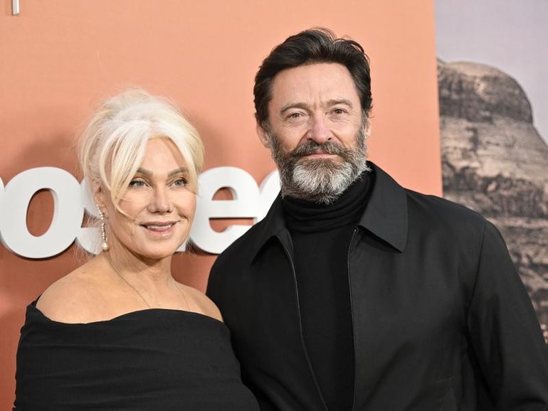 Deborra-Lee Furness and Hugh Jackman shocked fans when they announced their separation in 2023. (AP PHOTO)