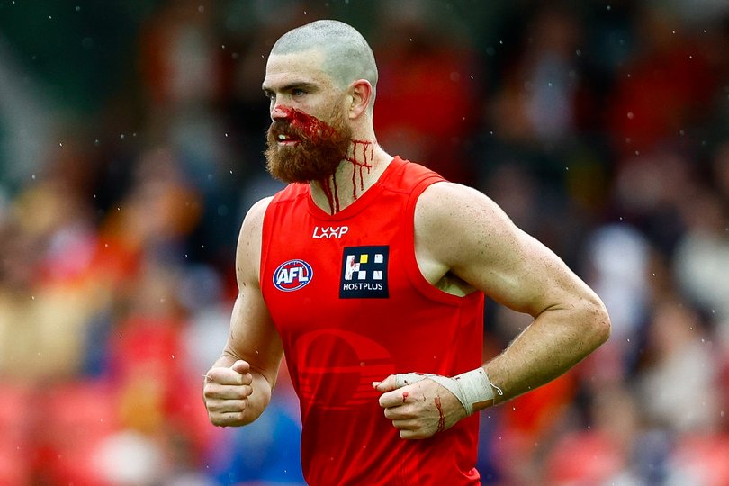 Sam Collins of the Suns leaves the field under the blood rule.