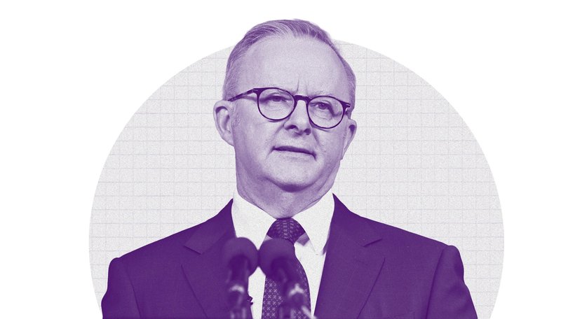 CAMERON MILNER: Anthony Albanese must come clean on a special deal for cashed up politicians.