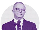 CAMERON MILNER: Anthony Albanese must come clean on a special deal for cashed up politicians. 