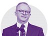 CAMERON MILNER: Anthony Albanese must come clean on a special deal for cashed up politicians. 