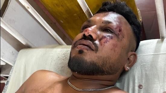 British man, Vishwash Kumar Ramash, has miracously survived the Air India plane crash that claimed the lives of over 200 people.