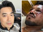 James Ruangsak Loychusak says he and Air India survivor British national Vishwashkumar Ramesh share an eerie coincidence. 