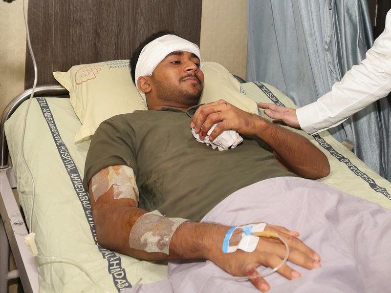 Vishwash Kumar Ramesh is the sole survivor of the crash that killed more than 240 people on board.