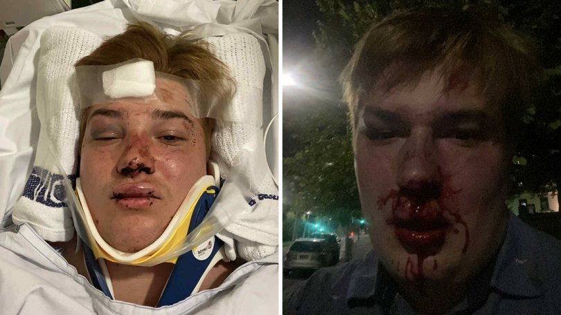 Jack thought he was meeting a man for a date. Instead, he was viciously gay bashed by eight youths in a park