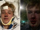 Jack thought he was meeting a man for a date. Instead, he was viciously gay bashed by eight youths in a park
