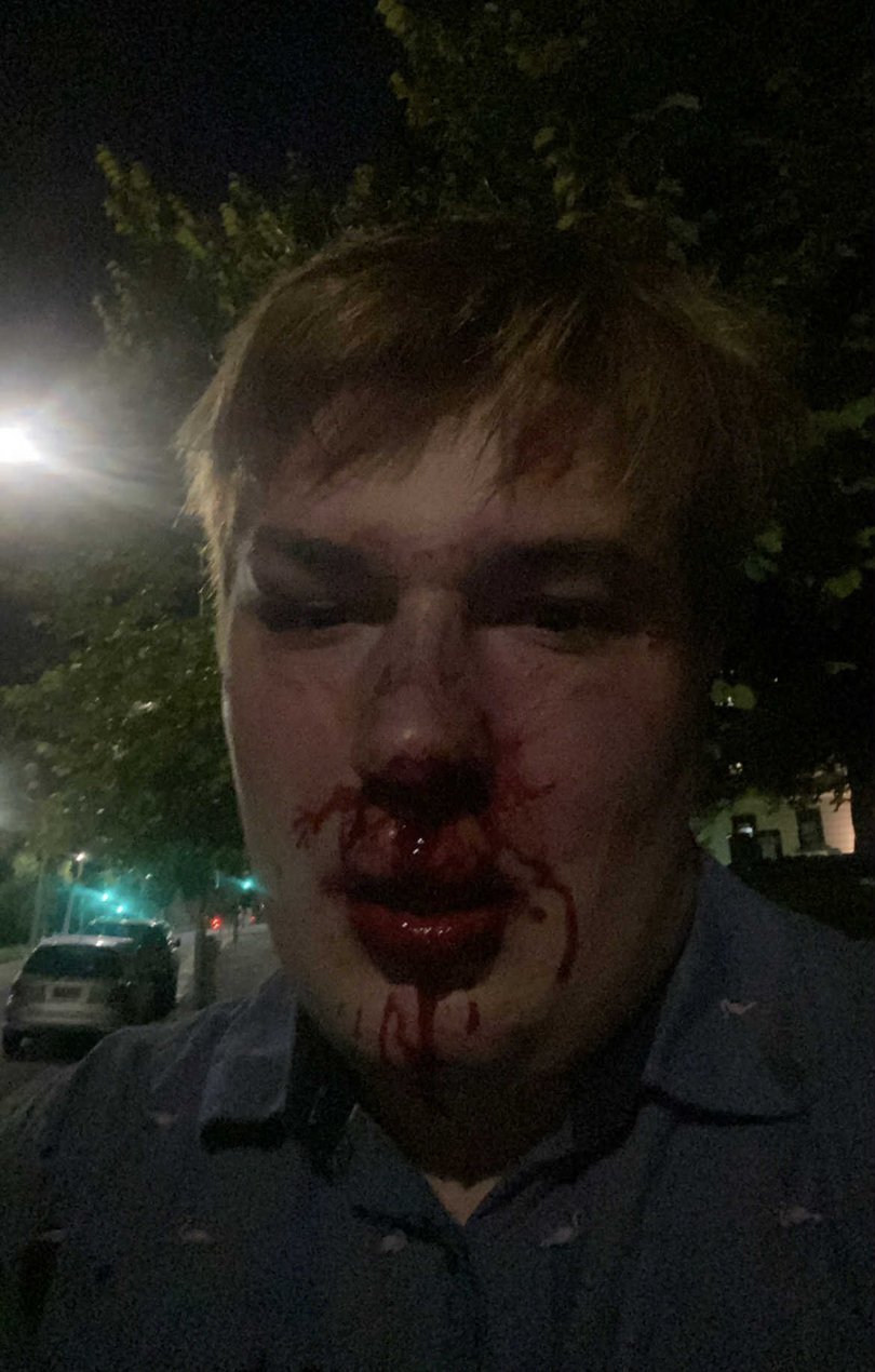 Jack, following the attack in Melbourne.