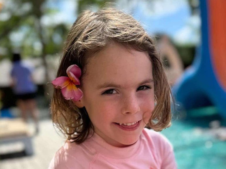 Marigold Jessie, 4, fights for life in an Adelaide hospital after falling from a tree house in Bali.