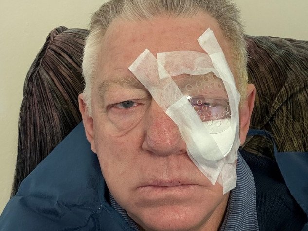 Phil Gould underwent eye surgery. 