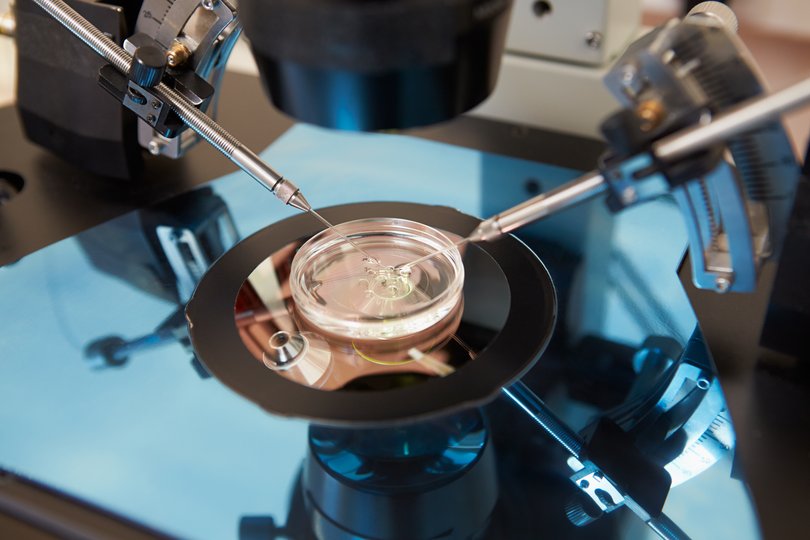 AI technology “STAR’” has proven successful in identifying “hidden sperm”.