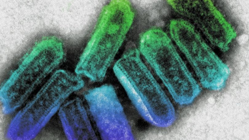 A transmission electron micrograph showing colorised bullet shaped Australian Bat lyssavirus particles. Supplied