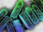 A transmission electron micrograph showing colorised bullet shaped Australian Bat lyssavirus particles. Supplied