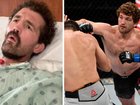 UFC fighter Ben Askren died four times in the past month.