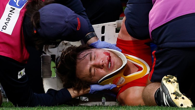 Melbourne midfielder Tom Sparrow after Sunday’s incident with Tristan Xerri.