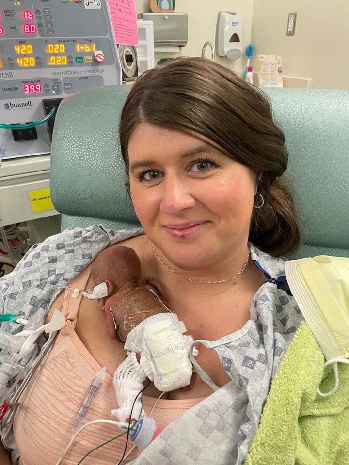 Nash Keen was born 133 days before his due date.
