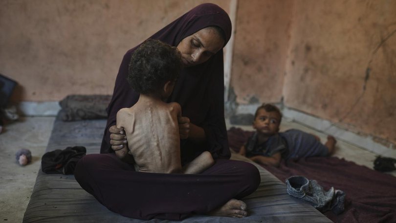 Gaza’s hospitals and aid workers warn of a deadly surge in child malnutrition and starvation.