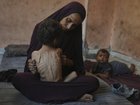 Gaza’s hospitals and aid workers warn of a deadly surge in child malnutrition and starvation.