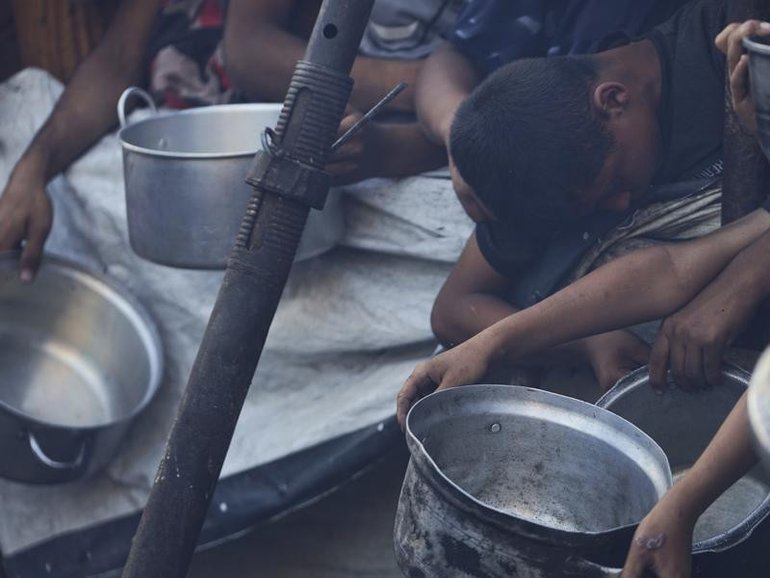 Acute malnutrition is surging among Gaza's two million people, particularly children, the WHO says. (AP PHOTO)