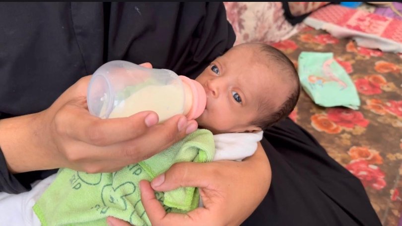 Mazen, the surviving twin, was recently re-hospitalised for malnutrition.