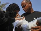 Five-month-old baby, Zainab, was allergic to cows milk and had no access to special formula in Gaza. (AP PHOTO)