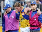 It’s season over for Harley Reid after Saturday’s injury late in the derby.