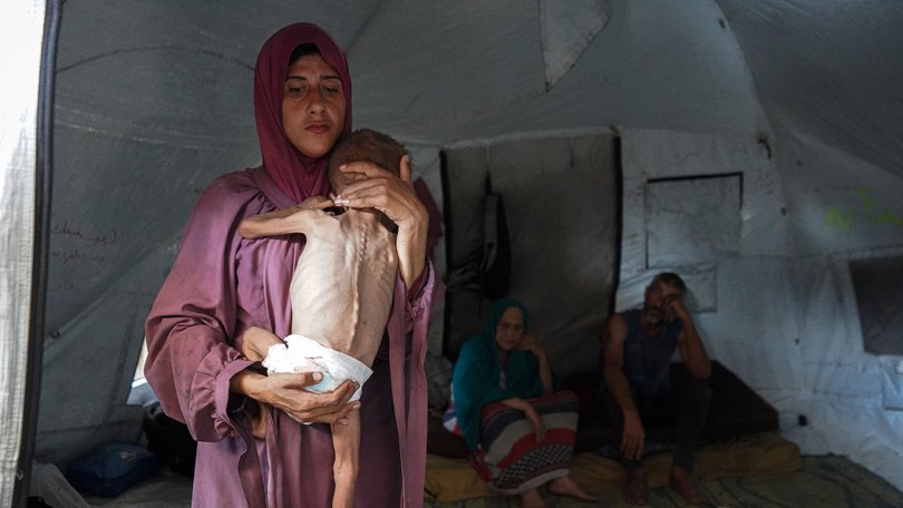 Photos of Muhammad Zakariya Ayyoub al-Matouq drew global attention to the Gaza humanitarian crisis. But an ‘Editor’s note’ has been added to one used by the New York Times. (Photo by Anas Zeyad Fteha/Anadolu via Getty Images)