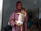 Photos of Muhammad Zakariya Ayyoub al-Matouq drew global attention to the Gaza humanitarian crisis. But an ‘Editor’s note’ has been added to one used by the New York Times. (Photo by Anas Zeyad Fteha/Anadolu via Getty Images)