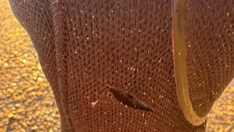 The shark caused damage to Bowie’s wetsuit. Picture: ABC