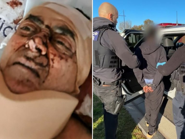 Four people, including three teens, have been arrested over a violent home invasion which left a man with serious injuries in Gladstone Park, Melbourne.