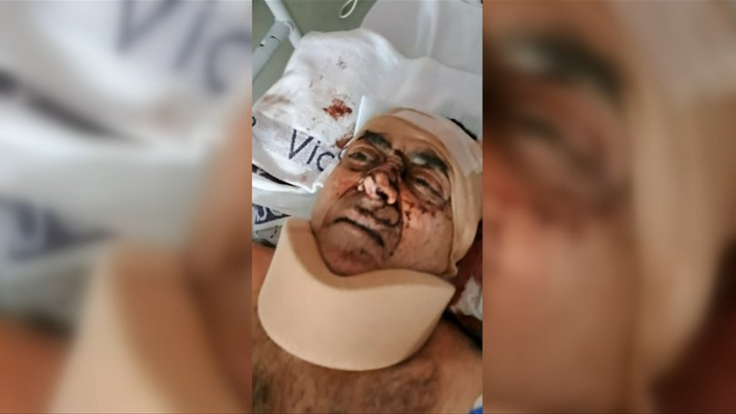 Kemal Akbulut, 60, was seriously injured in the violent home invasion.