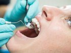 The tooth fairy is leaving Aussie kids an average of $6.20 for every lost tooth.