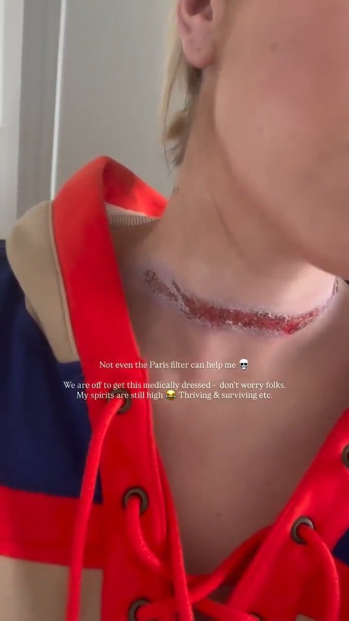 Eli Moulton was rushed to hospital after the accident.