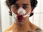 Mr Rudat suffered injuries to his face after saving two women from being attacked in Germany.
