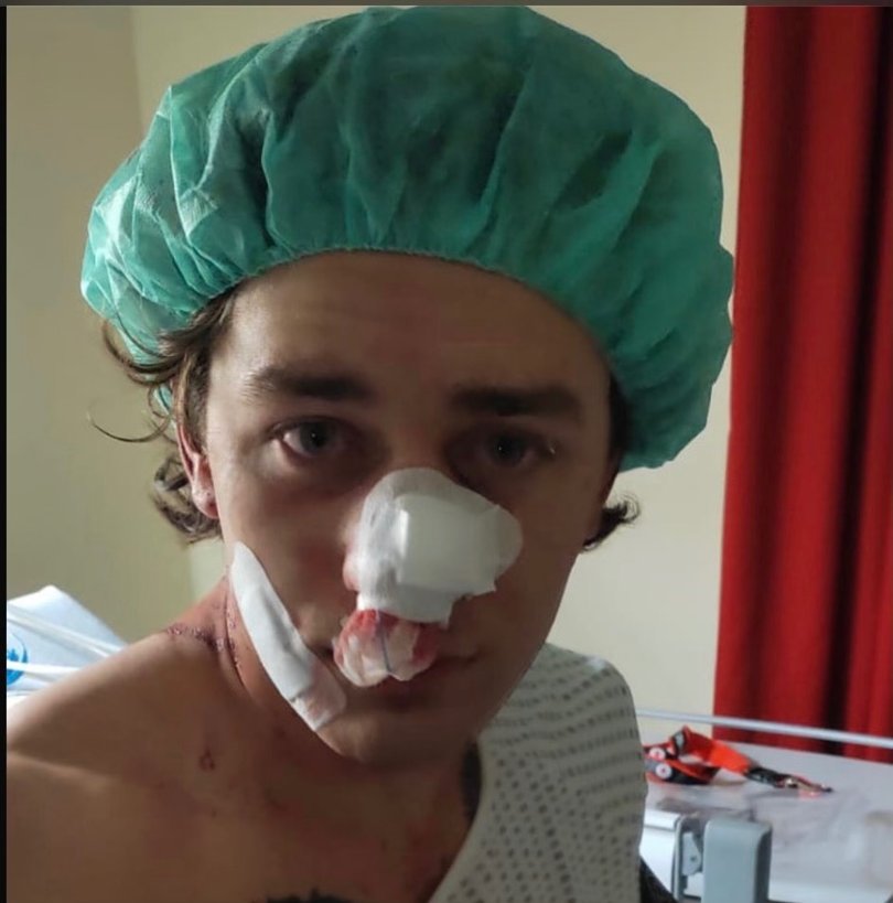 American helped save two women from being attacked by men on the tran, now in hospital.