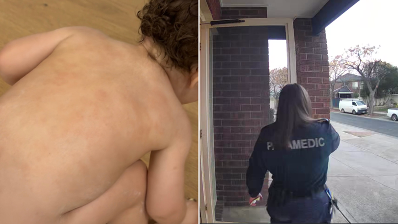 Grace Kolo’s son was still covered in rashes one week after paramedics were called.
