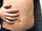 Urgent warning issued after outbreak across Queensland.