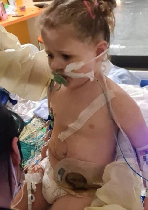 Millie has a stoma and faces several more surgeries.