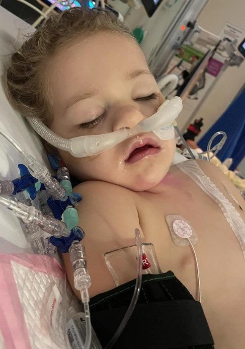 Millie was put in a coma.