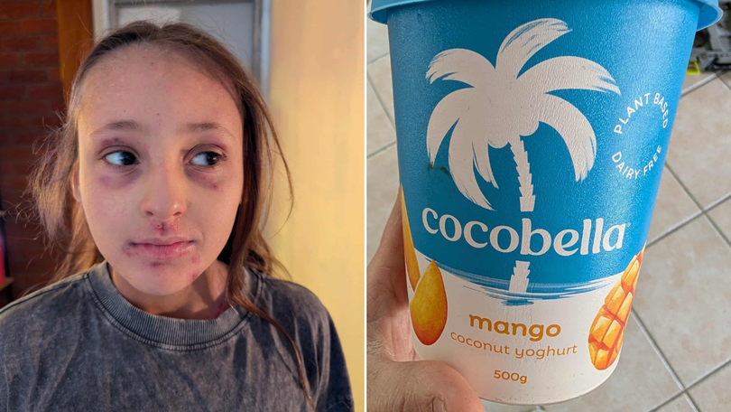 Ruby experienced a serious reaction after eating just three spoonfuls of Cocobella Mango yoghurt in 2024.