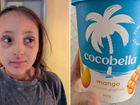Ruby experienced a serious reaction after eating just three spoonfuls of Cocobella Mango yoghurt in 2024.