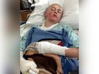 Caden Ballard, 12, suffered serious burns after a TikTok experiment went wrong.