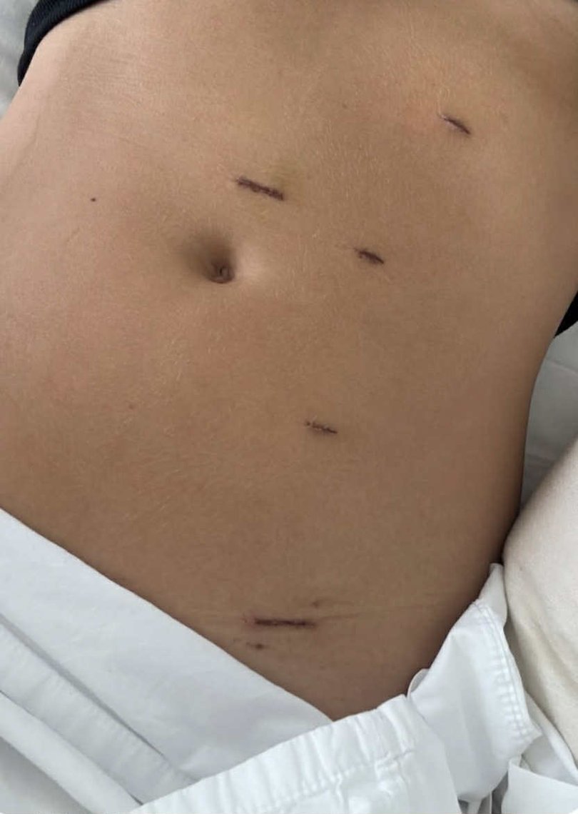 Oakley showed a number of confronting photos from the surgery.